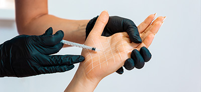 a person receiving an injection into their hand for excessive sweating from a beautician wearing black gloves