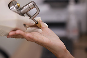 hand receiving treatment from a medical device featuring precision technology for health and beauty results within 12 treatments